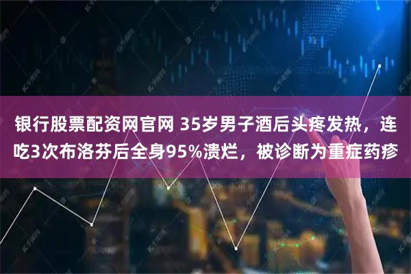 银行股票配资网官网 35岁男子酒后头疼发热，连吃3次布洛芬后全身95%溃烂，被诊断为重症药疹